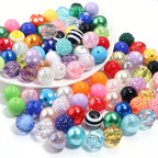 Multi-Color Bubblegum Beads 20mm Vibrant Solids Stripes Polka Dot Rhinestone 120pcs 3